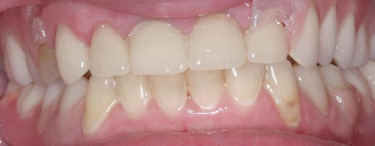 Cosmetic-Dentistry-After-Image