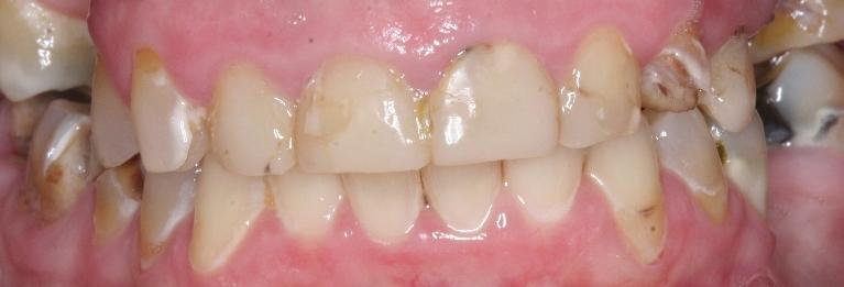 Cosmetic-Dentistry-Before-Image