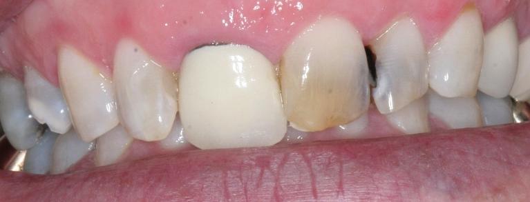 Cosmetic-Dentistry-Before-Image